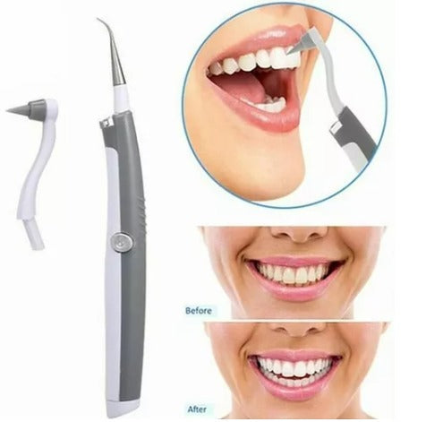 Limpiador Dental Sonic Pic con luz LED